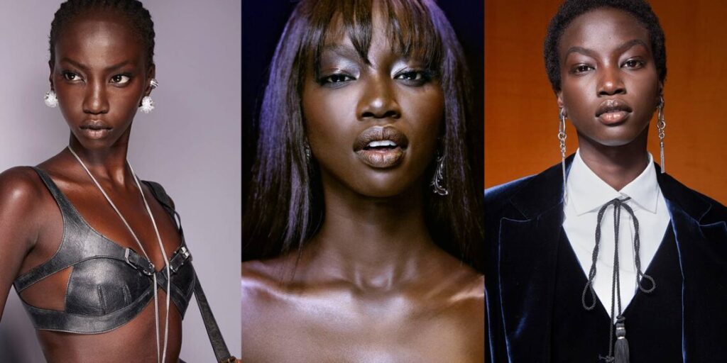 Anok Yai Recovery Journey After Major Lung Surgery (2026)