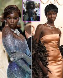 Anok Yai Recovery Journey After Major Lung Surgery (2026)